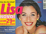 Liposuction or liposculpturing – Lisa