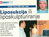 Liposuction or liposculpturing – Lisa